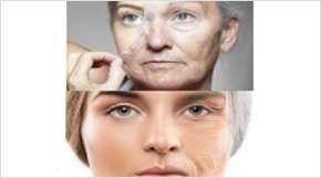 Botox, fillers (Reduce wrinkles)